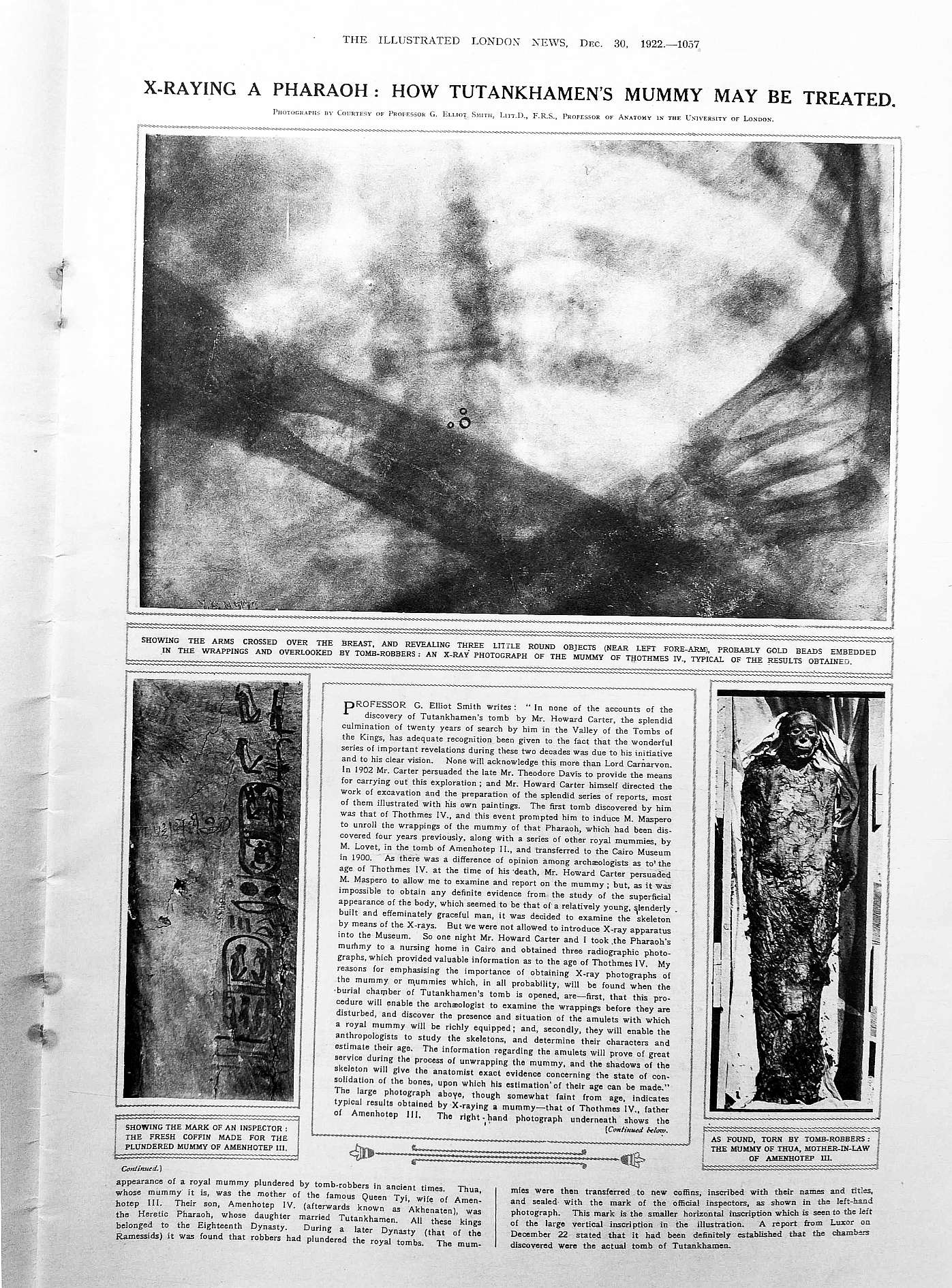 tut xray
